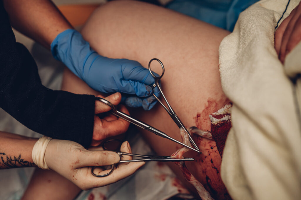 Geburtsfotografie Saarland