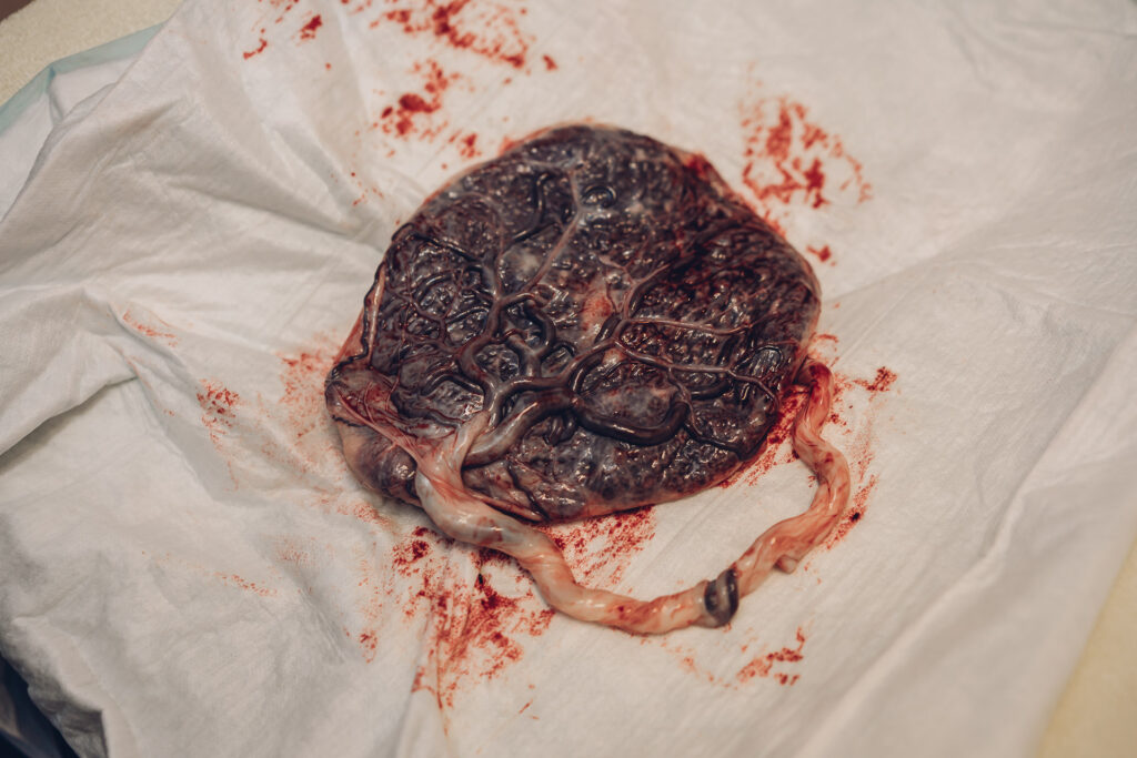 Geburtsfotografie Saarland