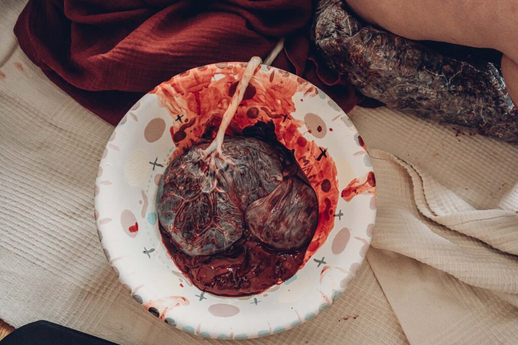 Geburtsfotografie Saarland